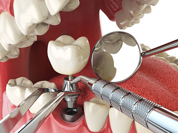  Jackson, LA Emergency Dentist Pros